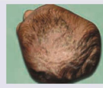 Image for question 173