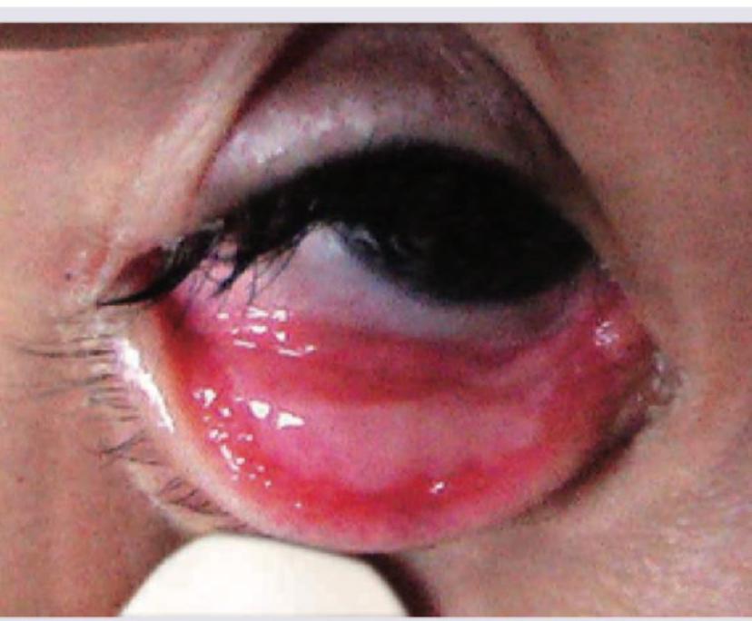 Image for question 265