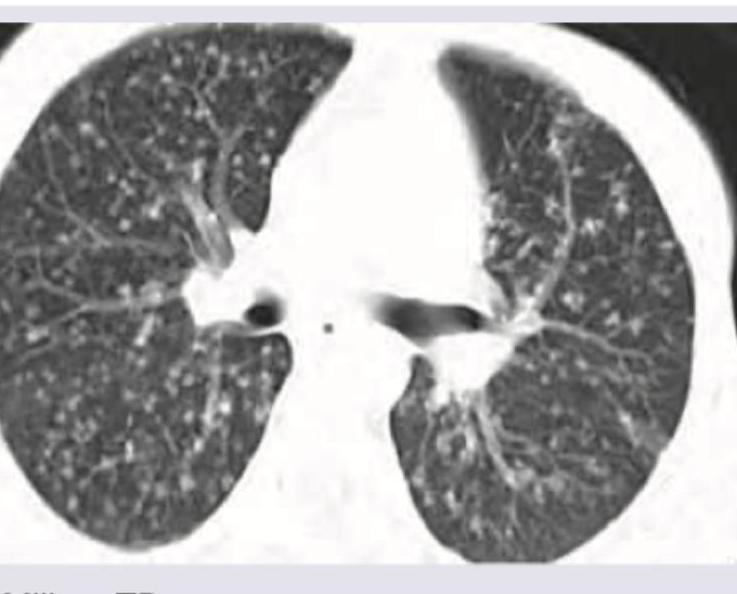 Image for question 368