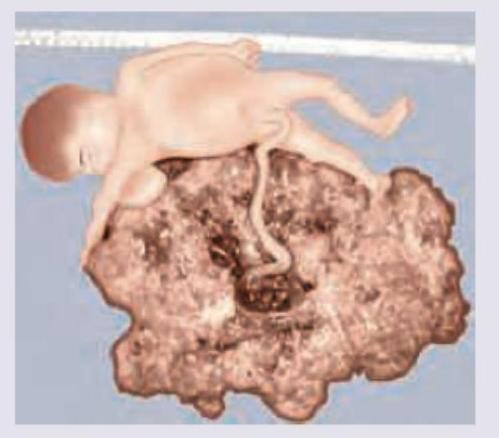 Image for question 930