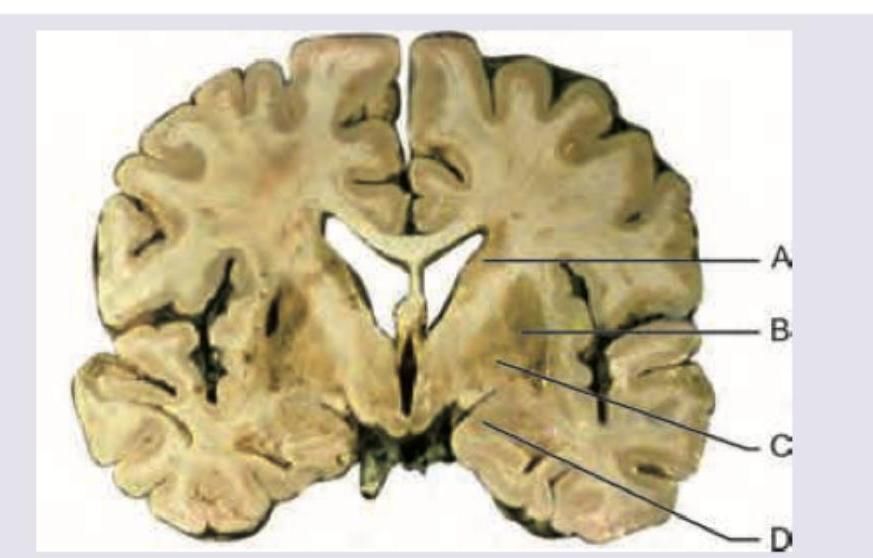 Image for question 76