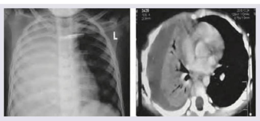 Image for question 234