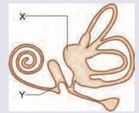 Image for question 181