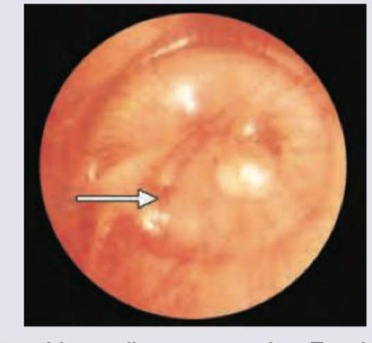 Image for question 203