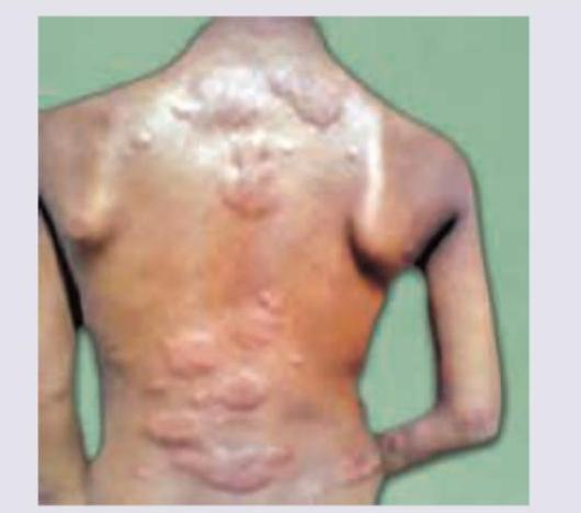 Image for question 75