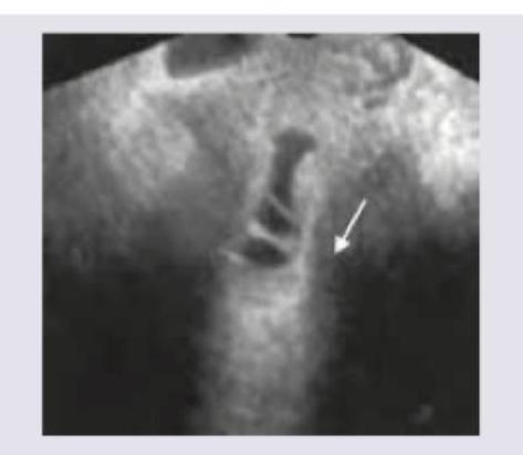 Image for question 2