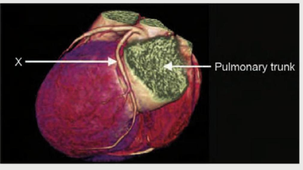 Image for question 100
