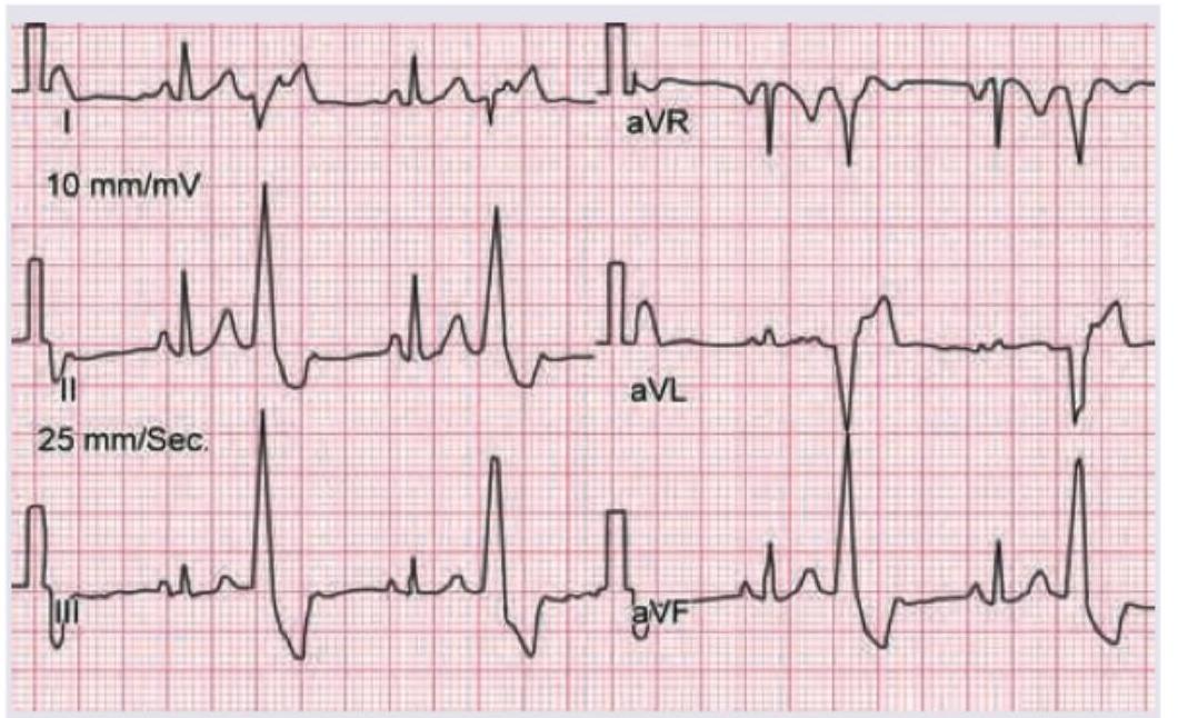 Image for question 2