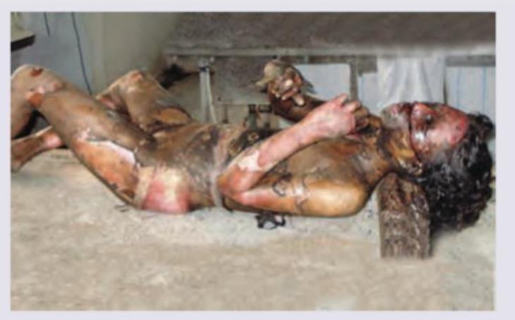 Image for question 236