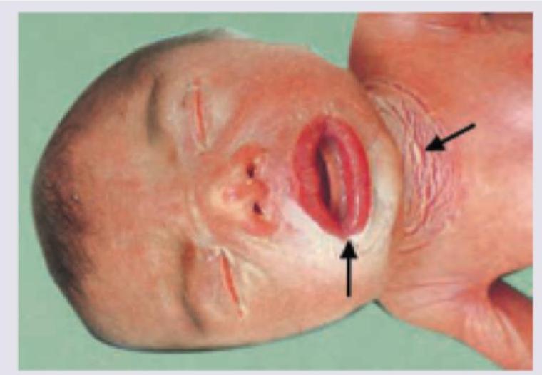 Image for question 748