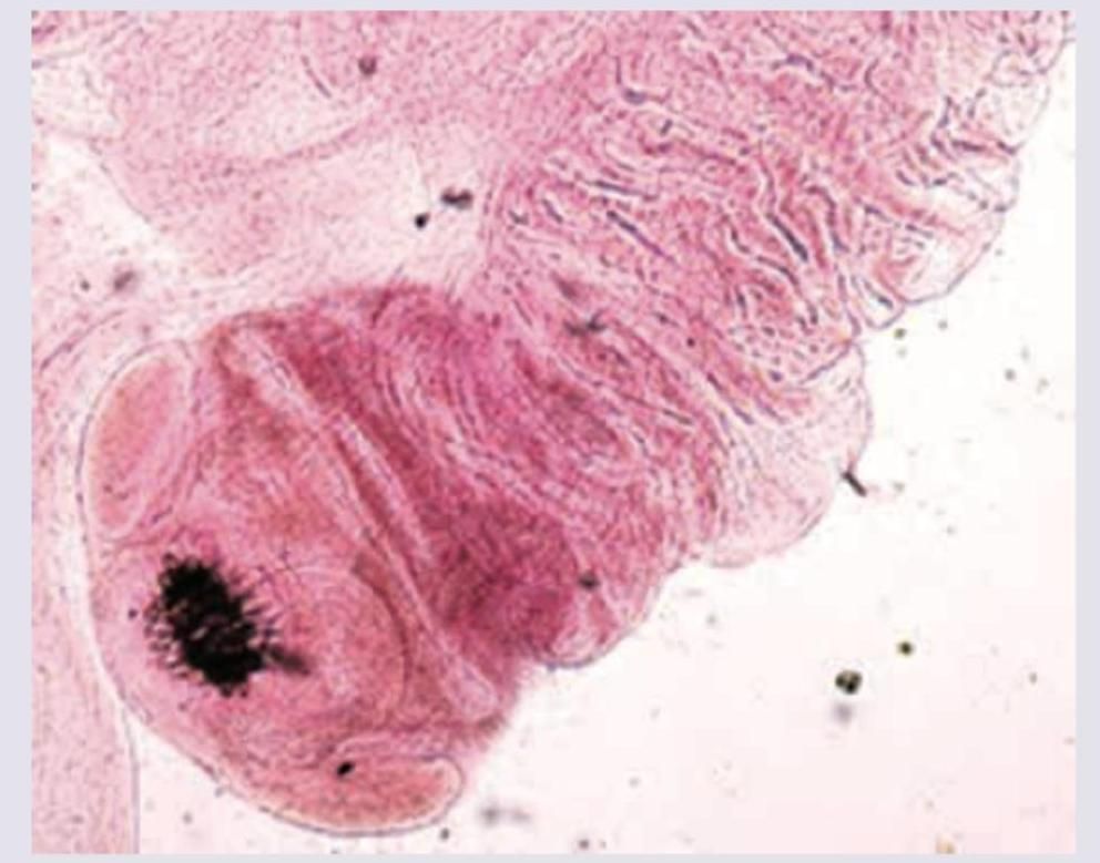 Image for question 41