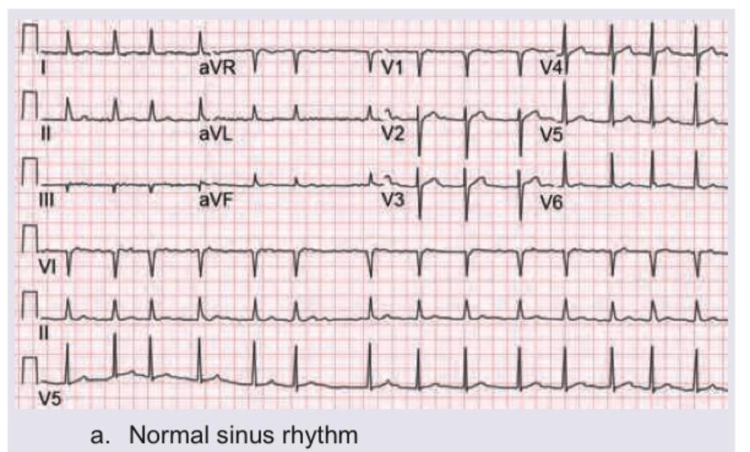 Image for question 1