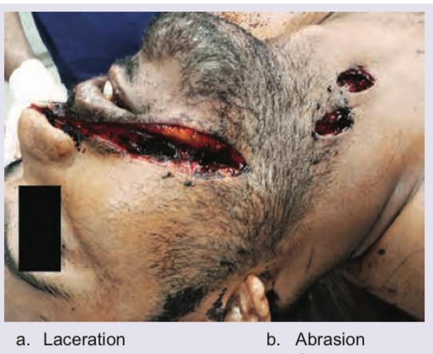 Image for question 9