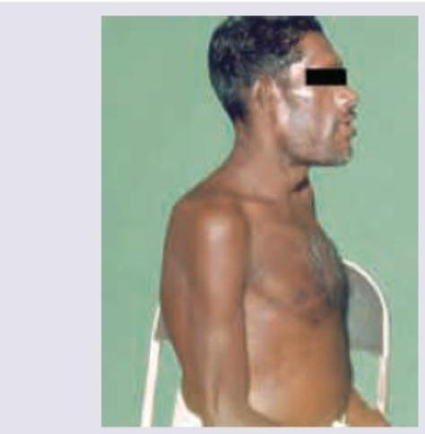 Image for question 69