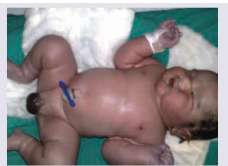 Image for question 733