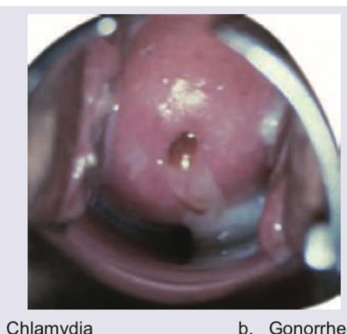 Image for question 1