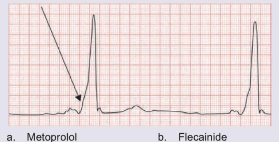 Image for question 961