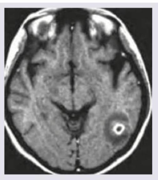 Image for question 57