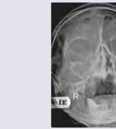 Image for question 356