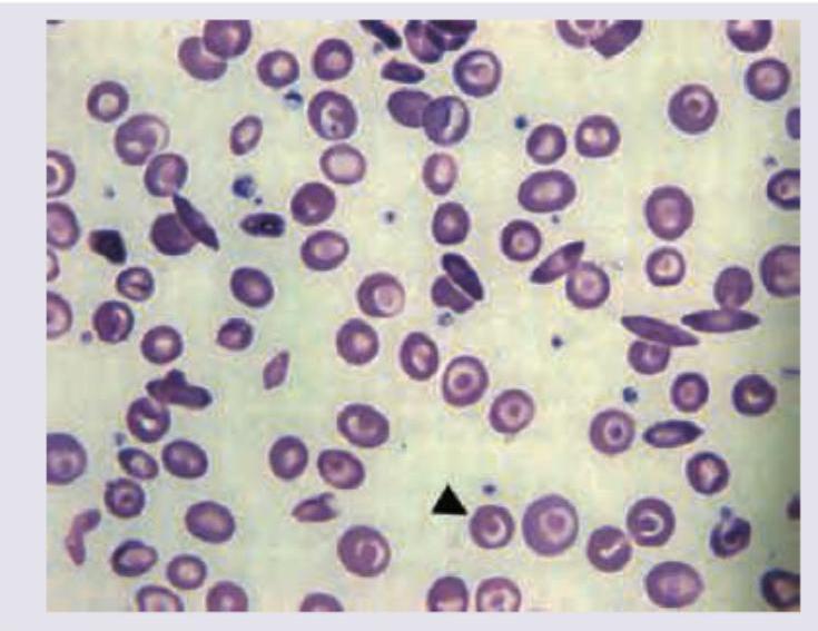 Image for question 862