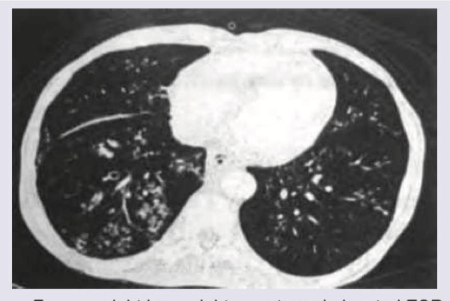 Image for question 59