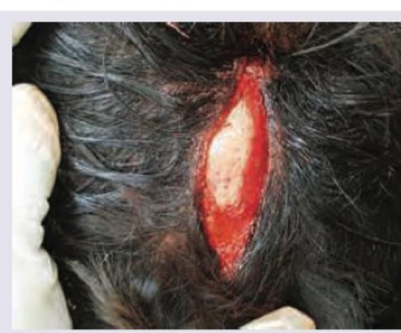 Image for question 501