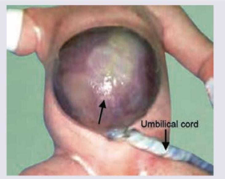 Image for question 980