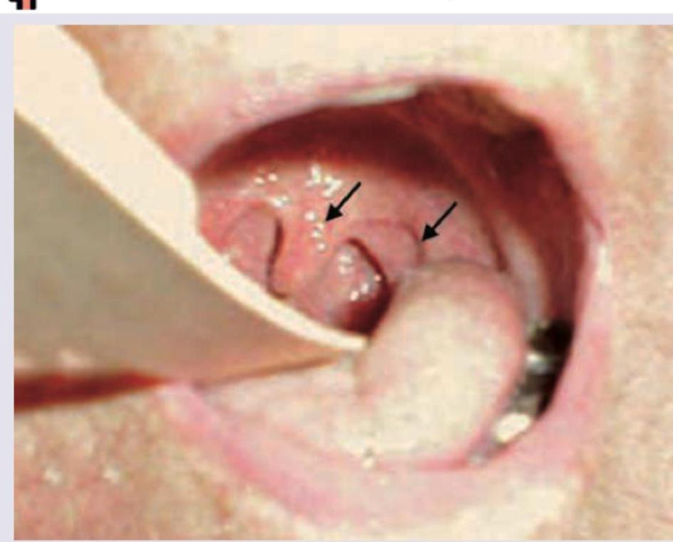 Image for question 252