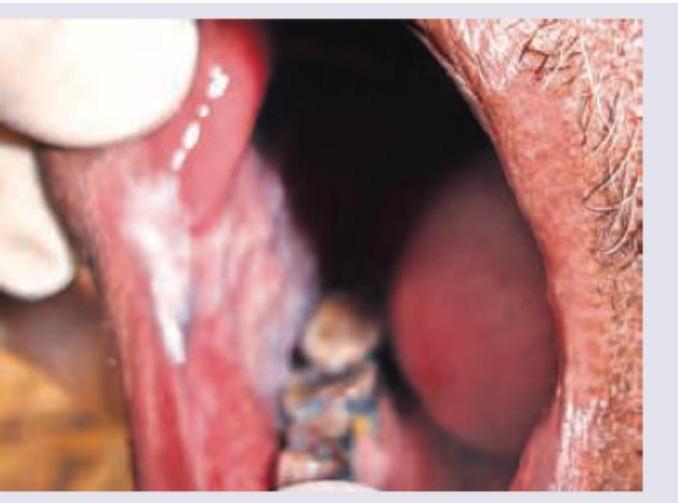 Image for question 457