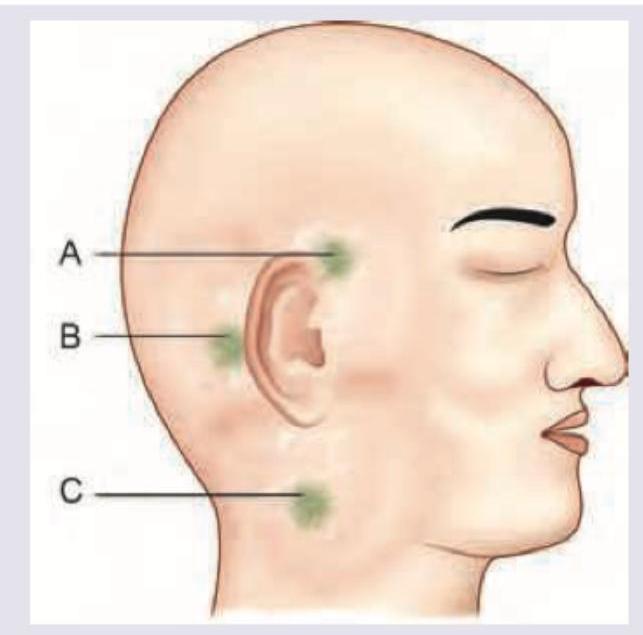 Image for question 195