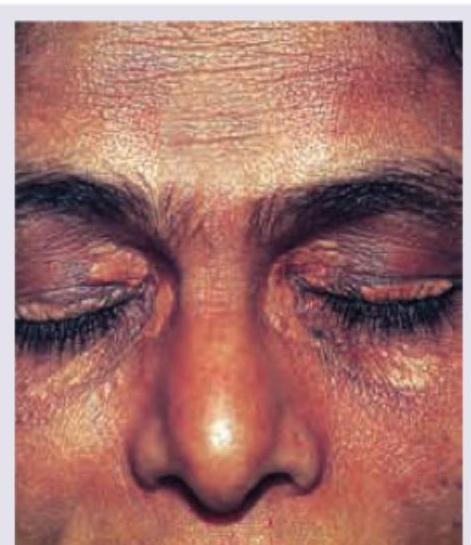 Image for question 83