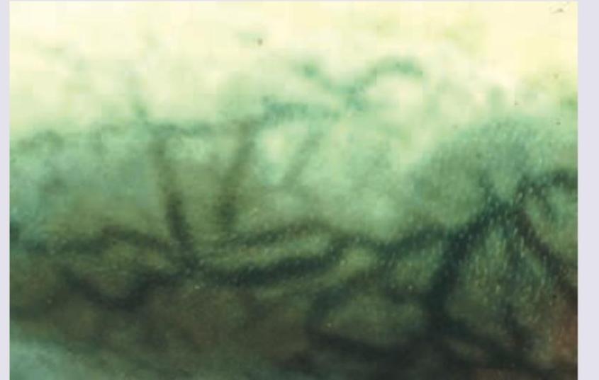 Image for question 131