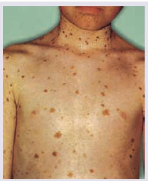 Image for question 87