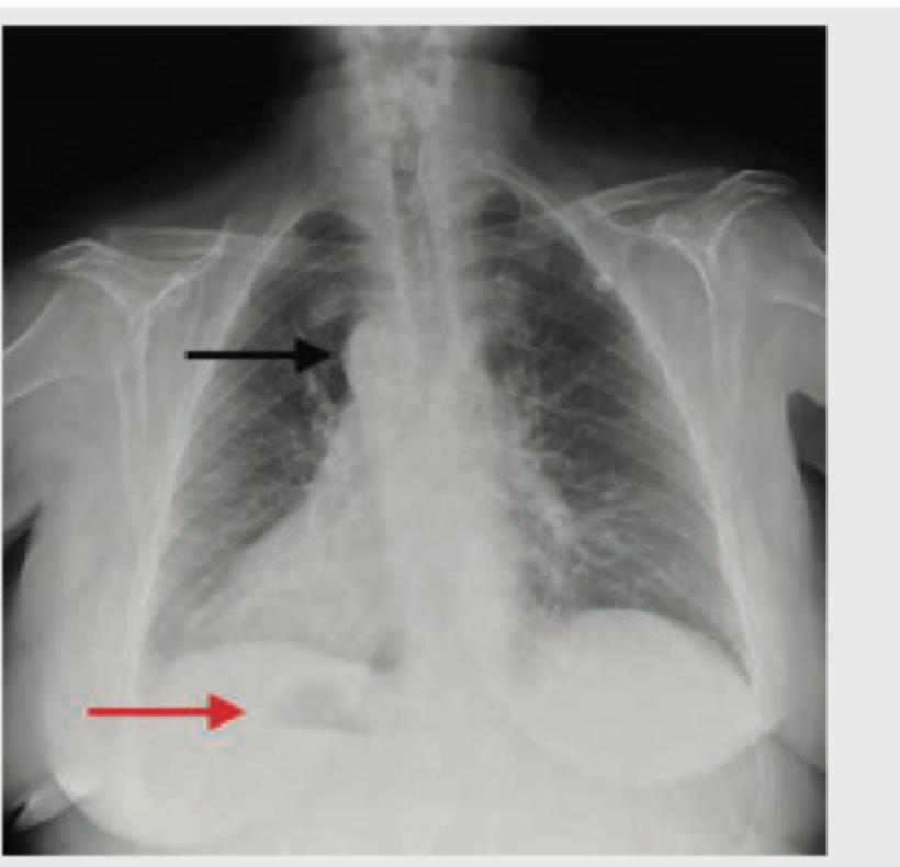 Image for question 145