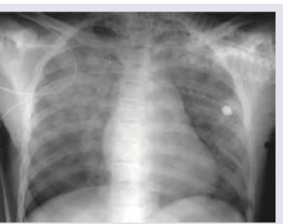 Image for question 77