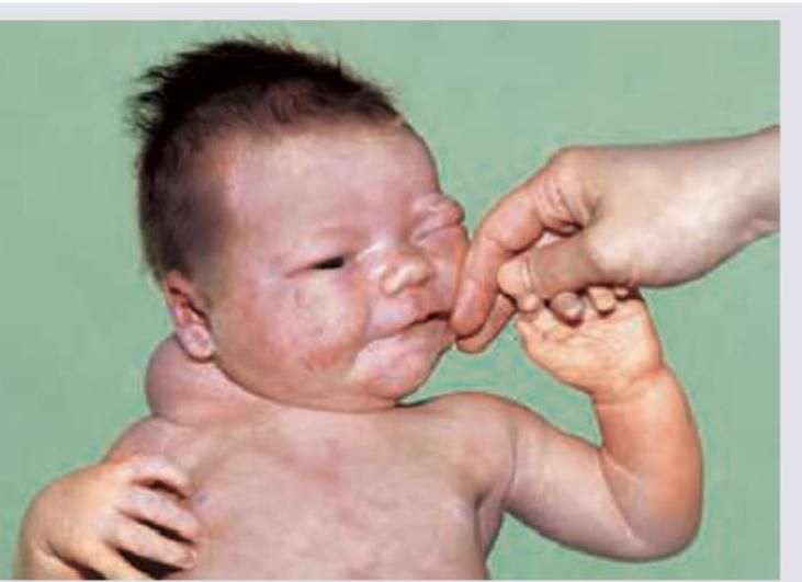 Image for question 123