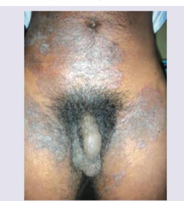 Image for question 108