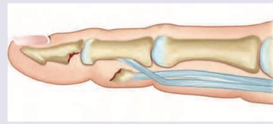 Image for question 312