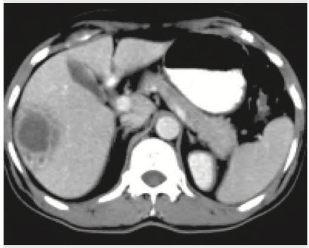 Image for question 68