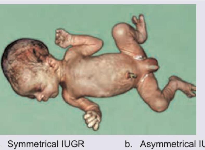 Image for question 649