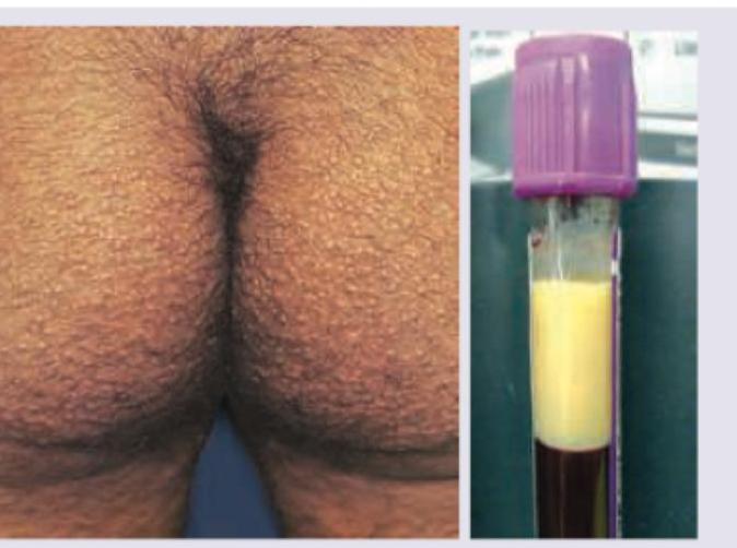 Image for question 254