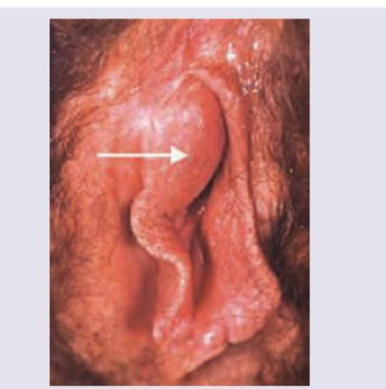 Image for question 121