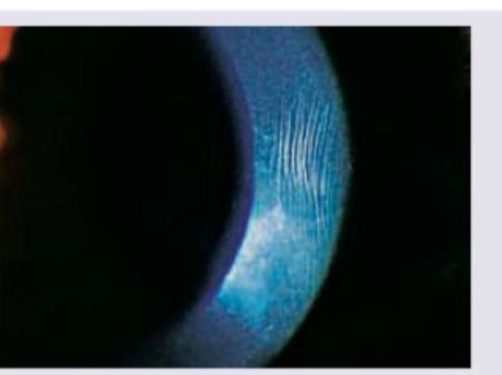 Image for question 323