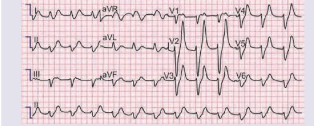 Image for question 638