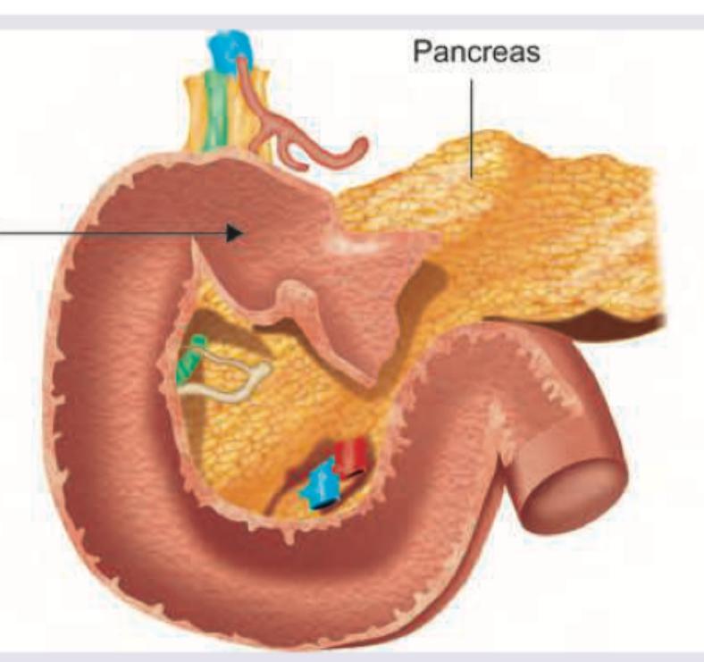 Image for question 705