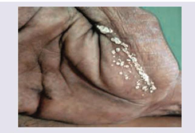 Image for question 495