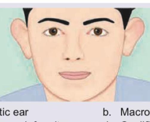 Image for question 342