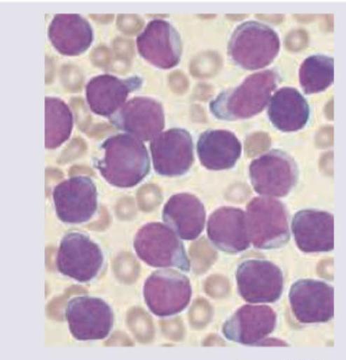 Image for question 173