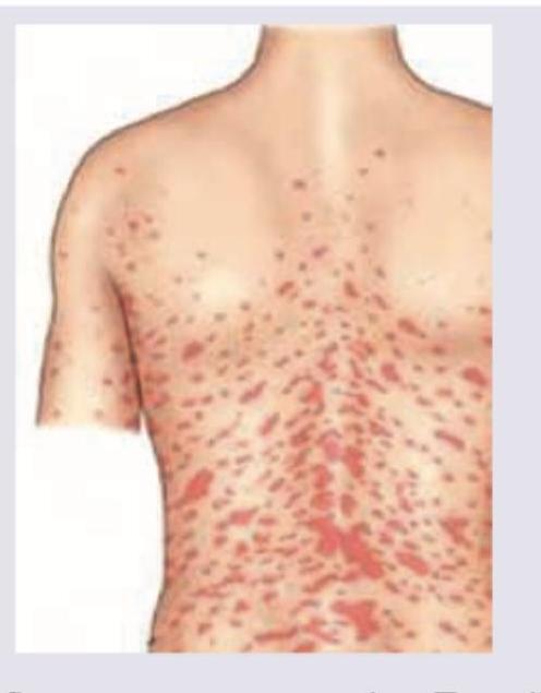 Image for question 177