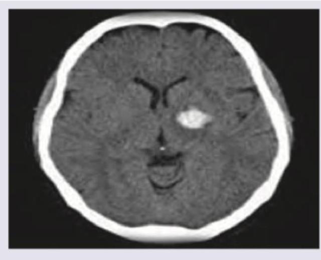 Image for question 4